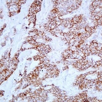 E Cadherin Mouse Monoclonal Antibody