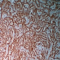 Calretinin Mouse Monoclonal Antibody
