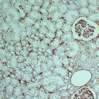 CD105 Antibody