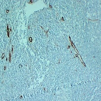 CD105 Antibody