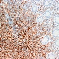 CD20 Antibody