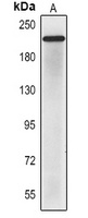 CD56 Antibody