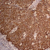 Cytokeratin 5 Antibody