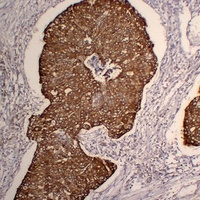 Cytokeratin 5 Antibody