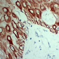 Cytokeratin 5 Antibody