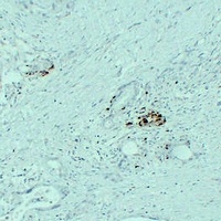 IGF2 Antibody