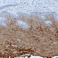 Annexin A1 Mouse Monoclonal Antibody