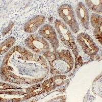 Cadherin pan Antibody