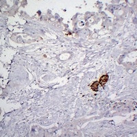 Chromogranin A Mouse Monoclonal Antibody