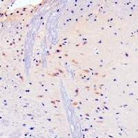 Chromogranin A Mouse Monoclonal Antibody