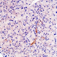 Chromogranin A Mouse Monoclonal Antibody