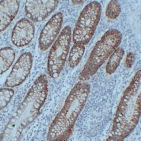 Claudin 3 Mouse Monoclonal Antibody