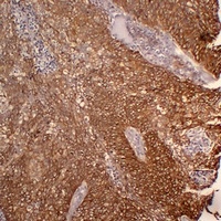 Cytokeratin 5 Antibody