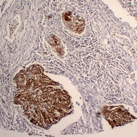 Cytokeratin 5 Antibody