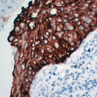 Cytokeratin 5 Antibody