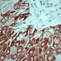 Cytokeratin 5 Antibody