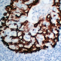 Cytokeratin 5 Antibody