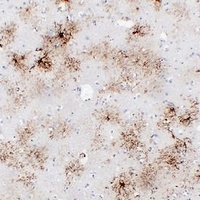GFAP Antibody