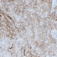 GFAP Antibody