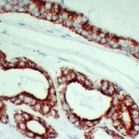 AMACR Mouse Monoclonal Antibody