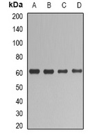 UGT1A1 Rabbit Polyclonal Antibody