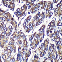 UGT1A1 Rabbit Polyclonal Antibody