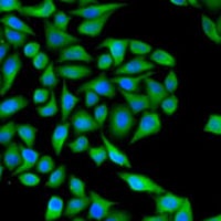 UGT1A1 Rabbit Polyclonal Antibody