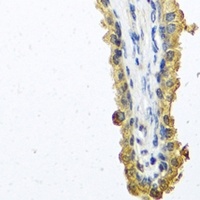 Cochlin Rabbit Polyclonal Antibody