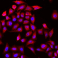 Cochlin Rabbit Polyclonal Antibody