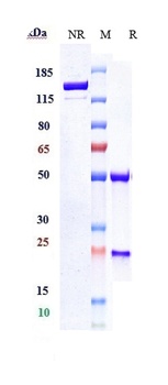 FOLH1/PSMA Antibody (MMAE)