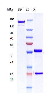 ERBB2/HER2/CD340 Antibody (MMAE)