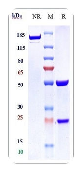 VEGFR2/KDR/CD309 Antibody