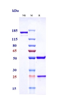 NaPi2b/SLC34A2 Antibody