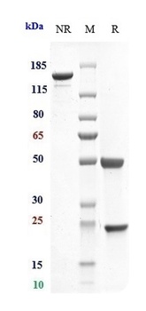 Integrin aL/ITGAL/CD11a Antibody