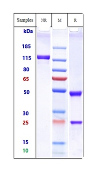 IgE Antibody
