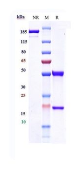 IGF1-R/IGFR1/CD221 Antibody