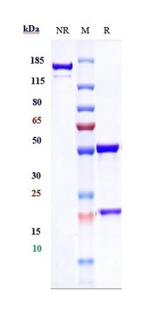 DCBLD2/ESDN Antibody
