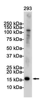 CDKN2A Rabbit mAb