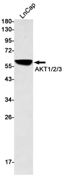 AKT Rabbit mAb