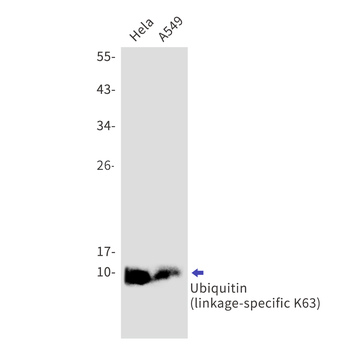 Ubiquitin K63 Rabbit mAb