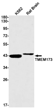 Transmembrane Protein 173 Rabbit mAb