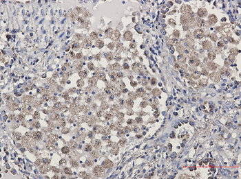 LAMP2 Rabbit mAb