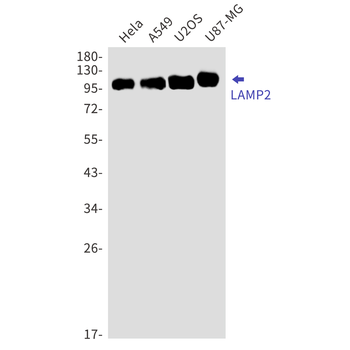 LAMP2 Rabbit mAb