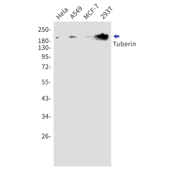 Tuberin Rabbit mAb