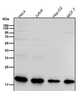 Superoxide Dismutase 1 Rabbit mAb