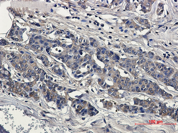 Superoxide Dismutase 1 Rabbit mAb