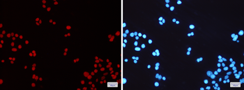MSH6 Rabbit mAb