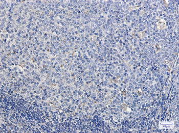 LAMP1 Rabbit mAb