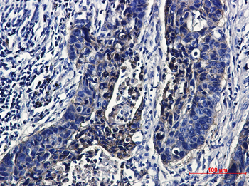 IGF1 Receptor Rabbit mAb