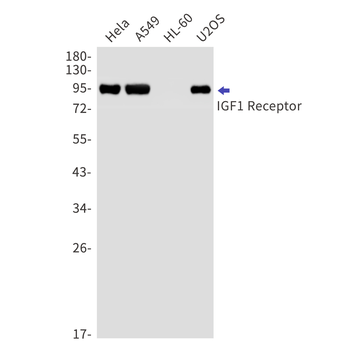 IGF1 Receptor Rabbit mAb